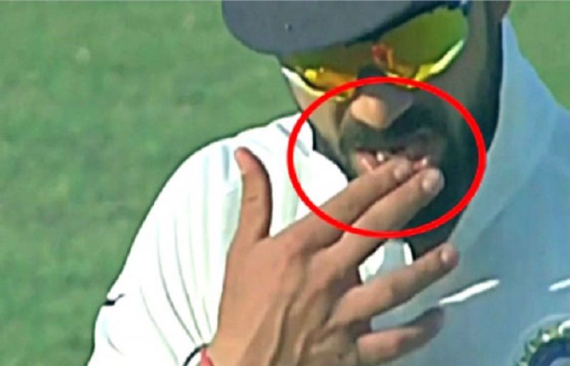 Virat Kohli Tampered With Ball In 1st Test Against England Such Tv 8642