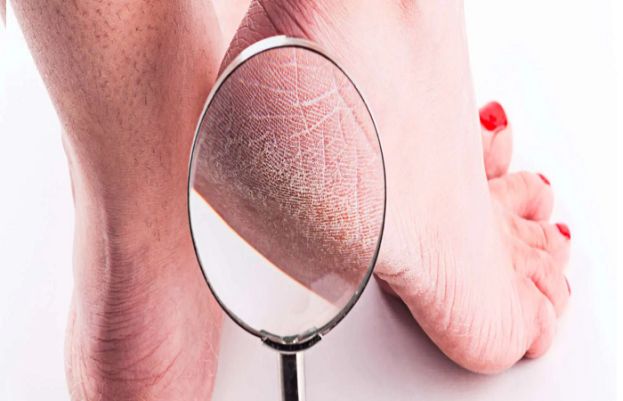How to get rid of dry skin on your feet