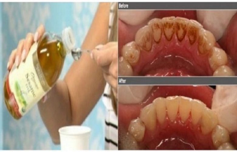 Kill harmful bacteria in your mouth with only one ingredient