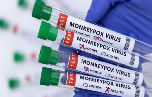 South Africa records first confirmed death from Mpox